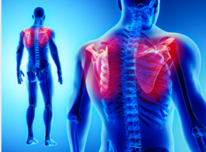 肩こり・夜間痛・眠れない