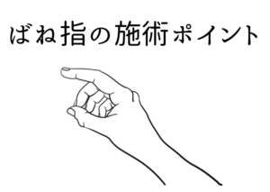 整体 ばね指